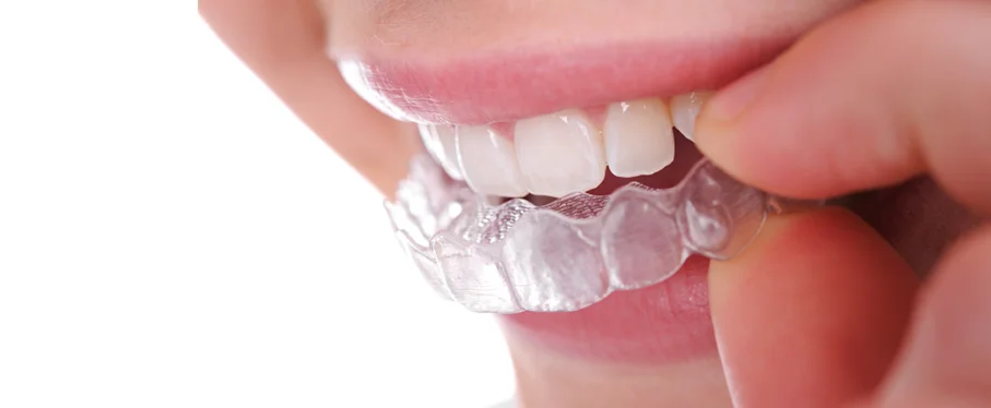 Cleaning your mouthguard
