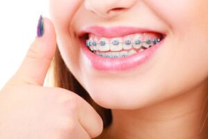 Healthy Smile with Orthodontic Services in Medicine Hat